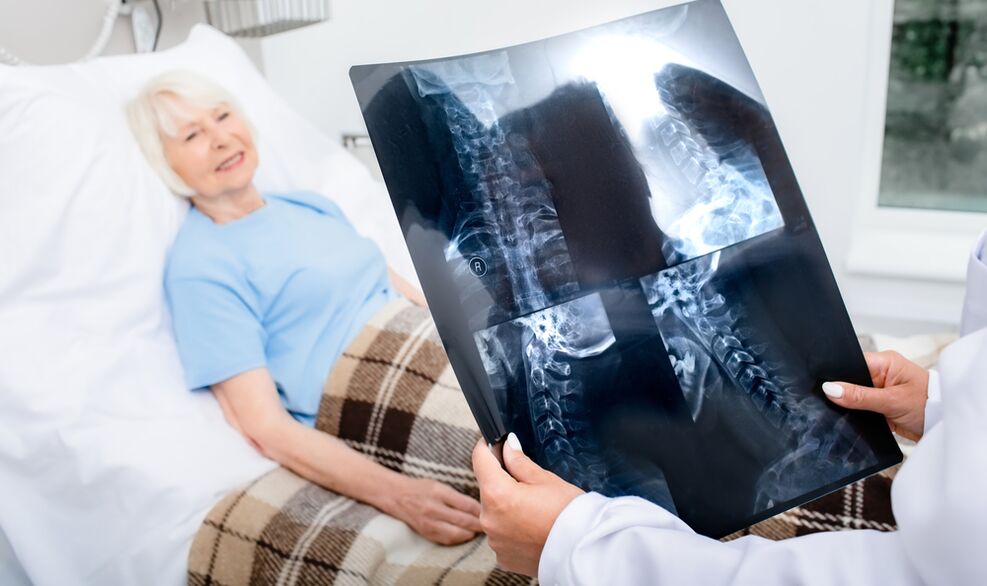 diagnostika osteochondrózy