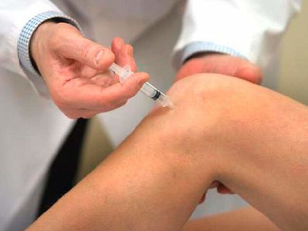 Intraartikulární injekce je jednou z nejprogresivnějších forem léčby artrózy kolenního kloubu